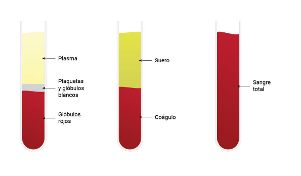 Amostras de sangue Como escolher o Tubo para coleta de sangue à vácuo corretamente.