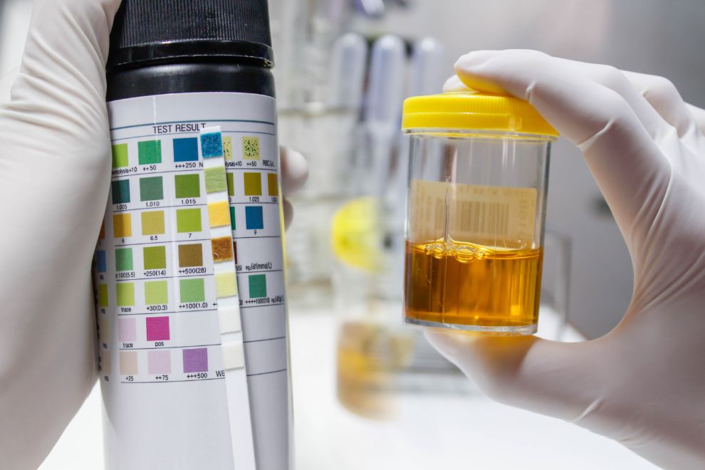 Analise de Agua 2 A Importância da Análise de Água - Entenda os procedimentos