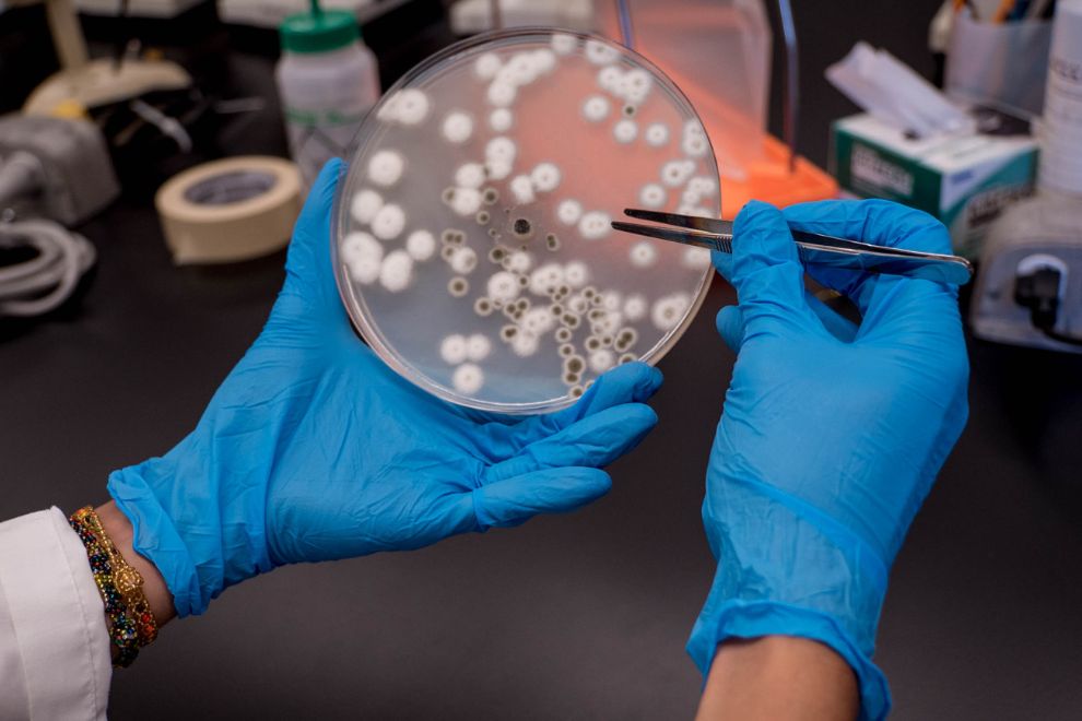 Caldo TSB 2 O que é o Caldo TSB? Função e Princípios em Microbiologia