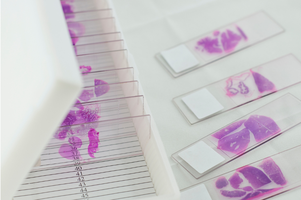 Cassete histologico 2 O que é Cassete Histológico- Saiba sua função no Laboratório.
