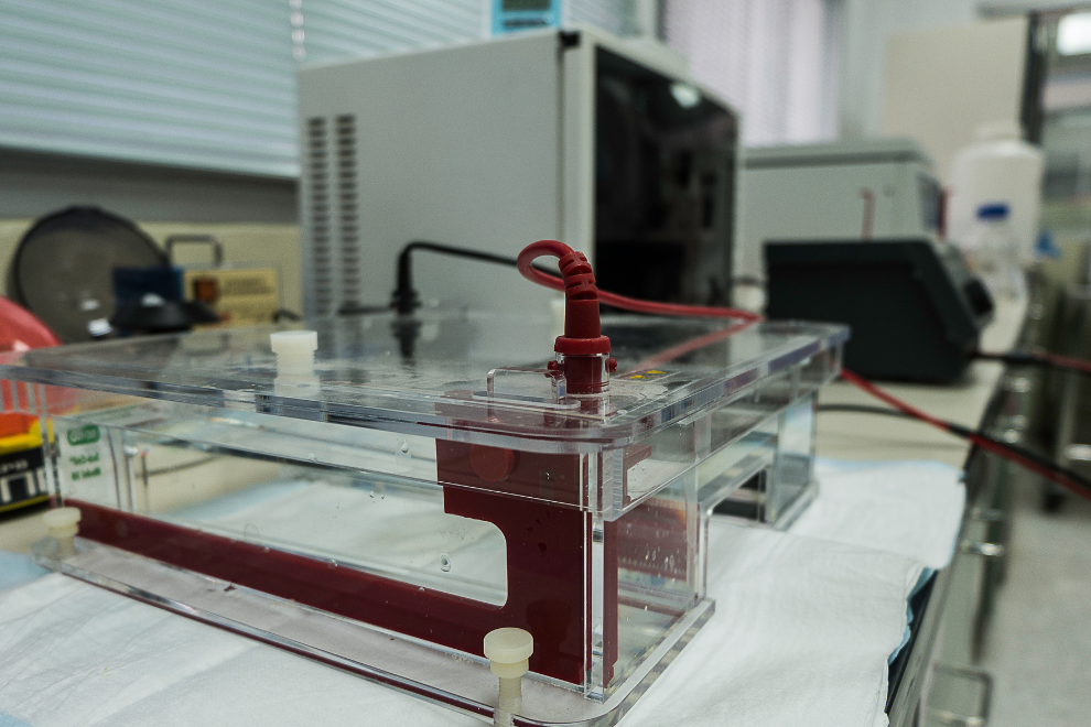 Eletroforese 1080 × 1980 px 1600 × 700 px 990 × 660 O que é Agarose? Trabalhando com Eletroforese