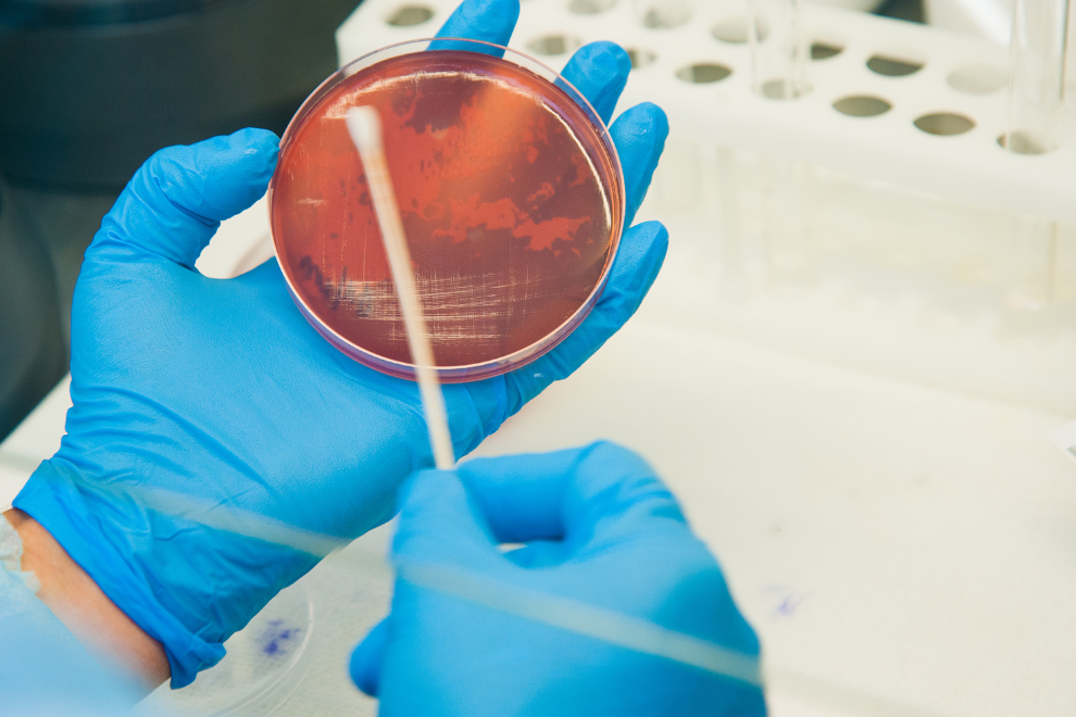 Extrato de Malte 1600 × 700 px 990 × 660 Como o Extrato de Malte é Importante para a Microbiologia