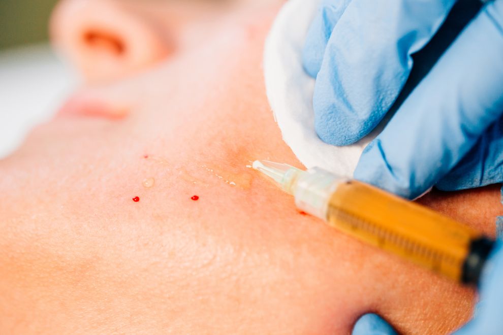 O que é uma Incubadora Plasma Gel? Qual a sua função?