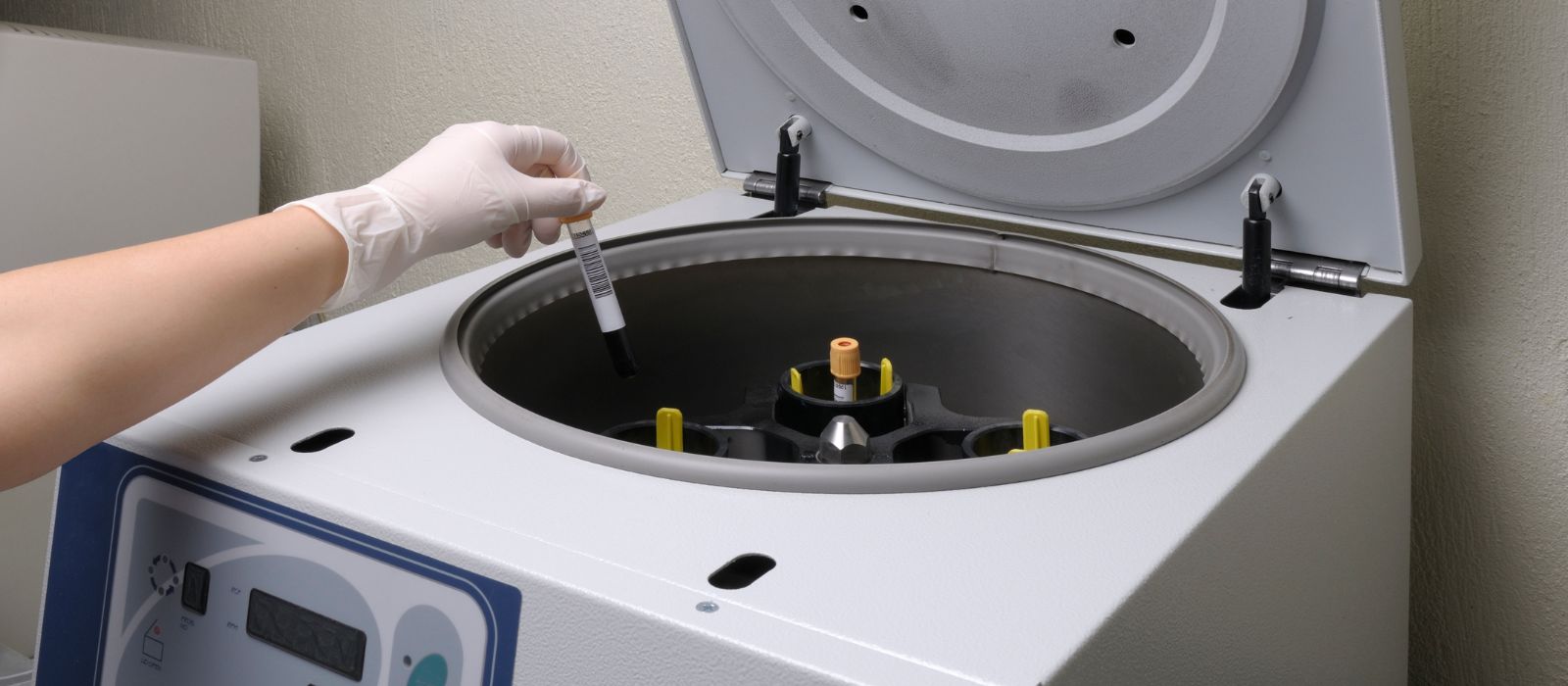 centrifuga para laboratorio 2 Para que serve uma centrífuga de laboratório? Aplicações