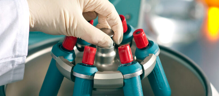 centrifugablogsplabor