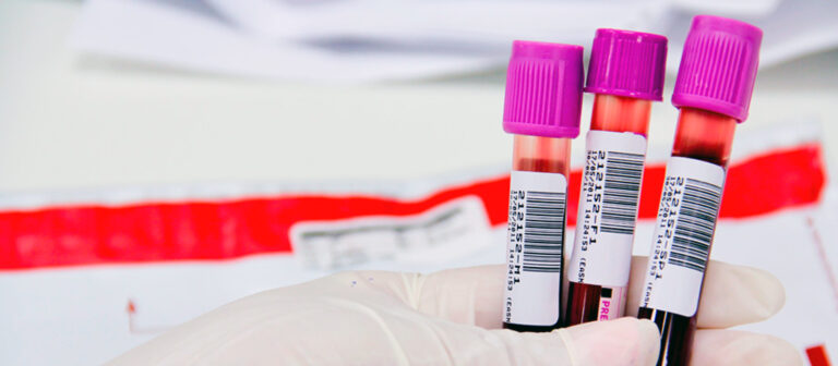 hemogramablogsplabor