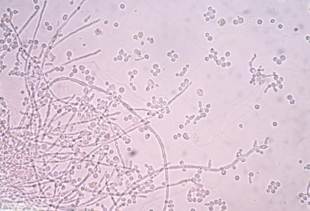 lamina O que são Lâminas e qual a sua importância na Microscopia
