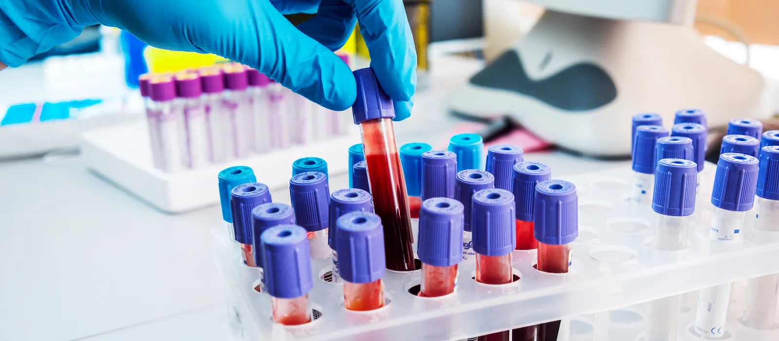O que é o Banho Seco para Laboratório- Saiba a Função