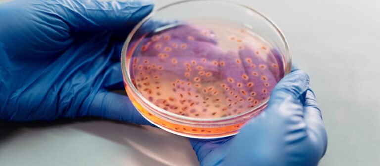 contagem de bacterias (1600 x 700 px)